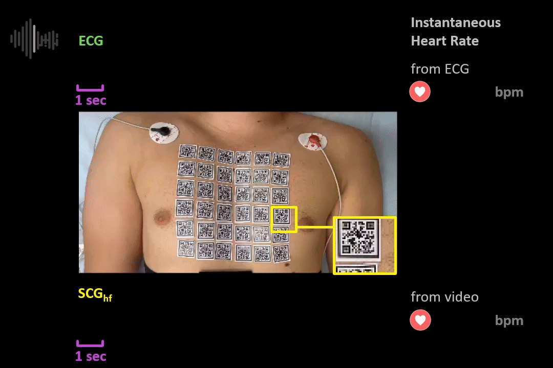 Heart Rate Estimation