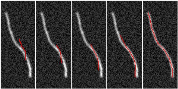 2d snake deforming to simulated image