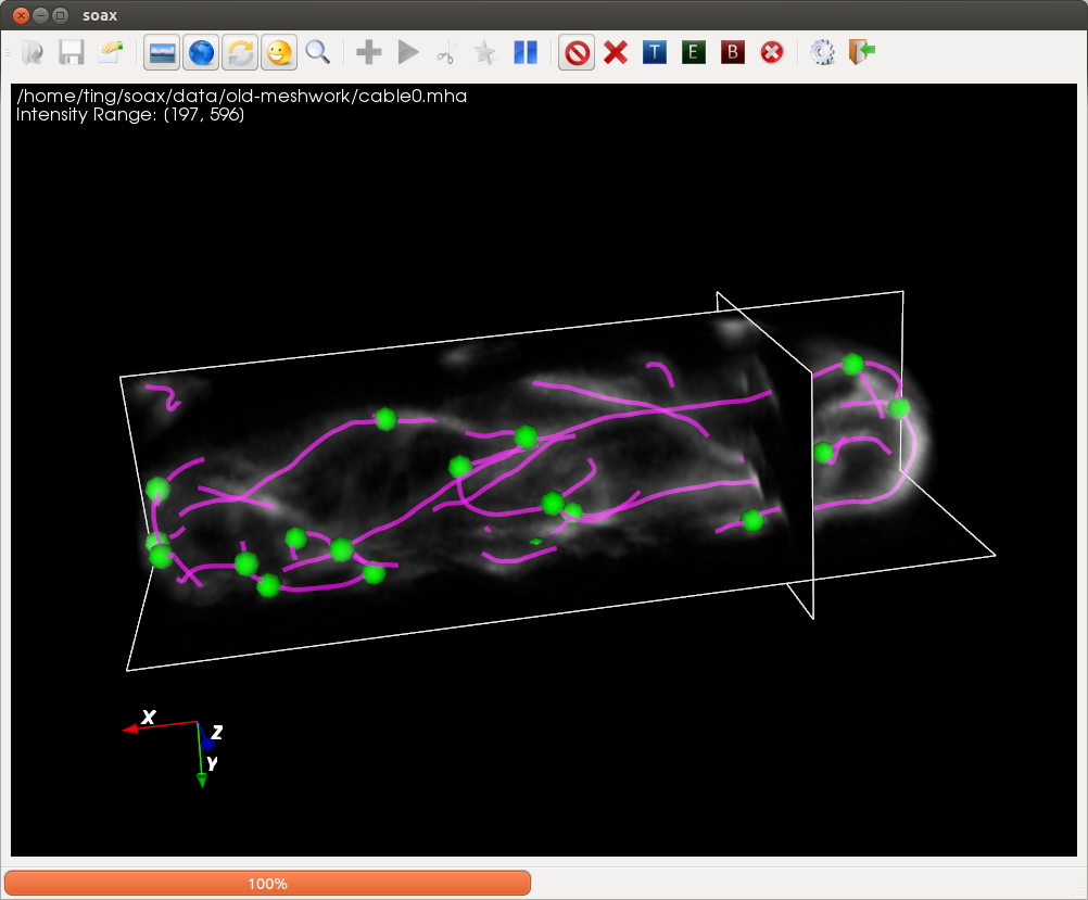 Actin cable example