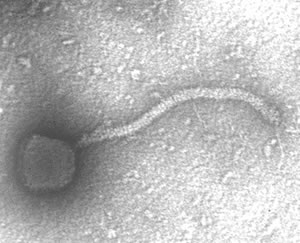 From BioS 118 - Phage EM