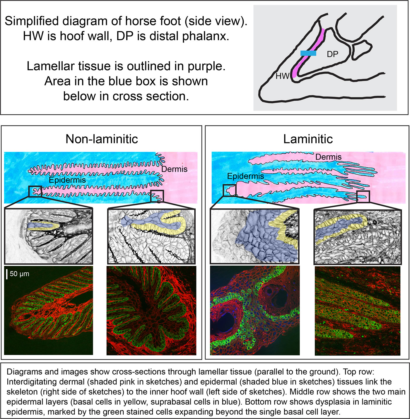 Figure (left):   Simplified diagram of horse foot (side view). HW is hoof wall, DP is distal phalanx. Lamellar tissue is outlined in purple. Area in blue box shown below in cross section.
Figure (right): Diagrams and images show cross-sections through lamellar tissue (parallel to the ground). 
Top row:  Interdigitating dermal (shaded pink in sketches) and epidermal (shaded blue in sketches) tissues link the skeleton (right side of sketches) to the inner hoof wall (left side of sketches). Middle row shows the two main epidermal layers (basal cells in pink, suprabasal cells in blue). Bottom row shows dysplasia in laminitic epidermis, marked by the green stained cells expanding beyond the single basal cell layer.