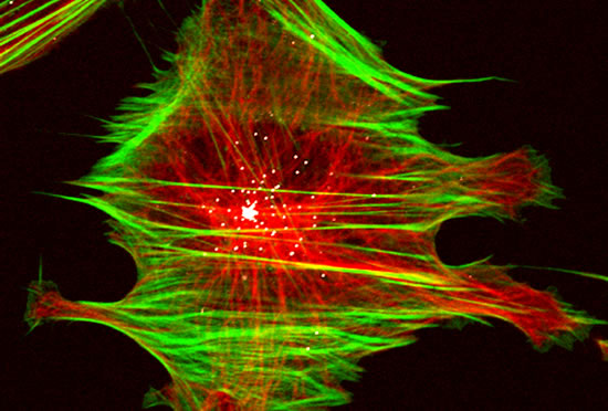 Human lung epithelial cell infected with adenovirus (white dots).  Microtubules (red) and actin filaments (green).  The virus uses the microtubule cytoskeleton to reach the host cell's nucleus.