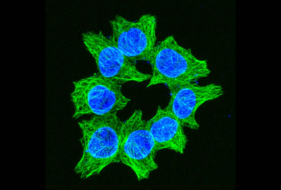 Human colon cancer cells in culture.  Microtubules (green) and DNA (blue) stains.