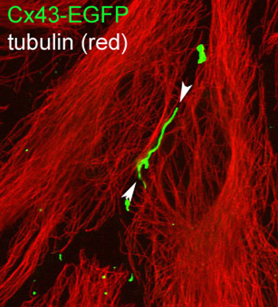 Zebrafish Cx43-EGFP expression in HeLa cells (tubulin is shown in red).